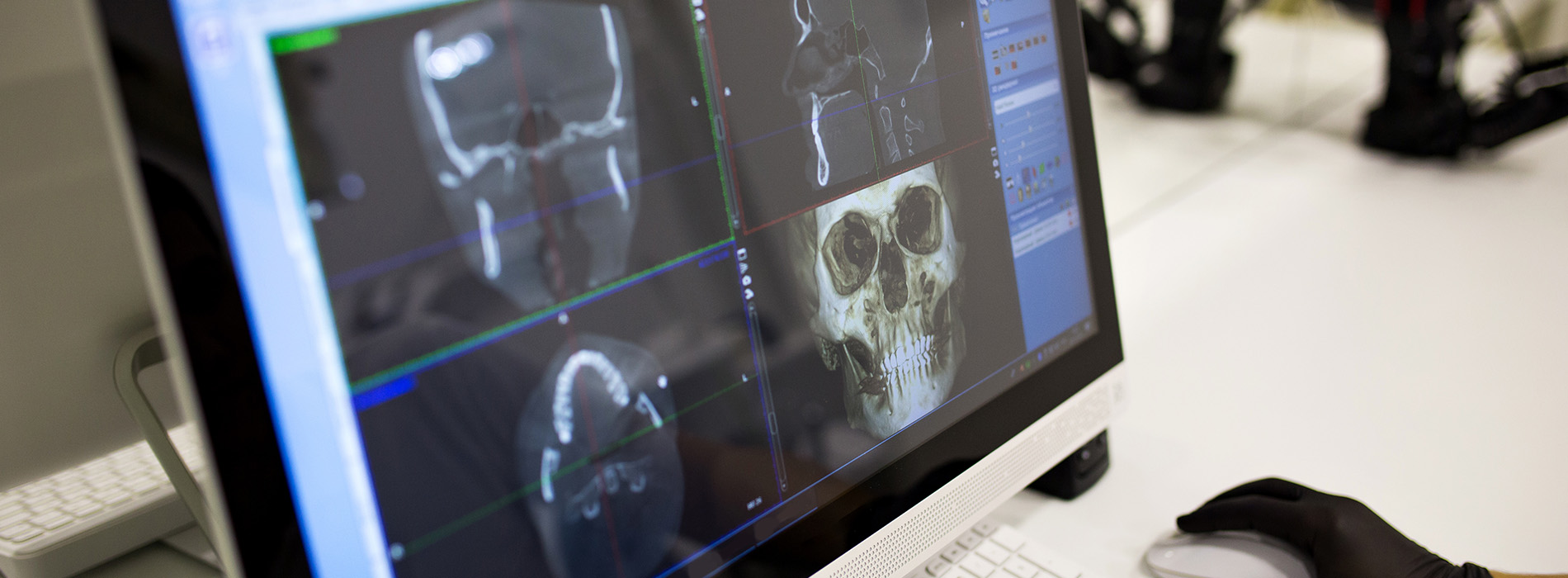 The image shows a computer screen displaying an X-ray with a skull on it, placed on a desk with other items around it.
